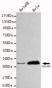 SDCBP Monoclonal Antibody