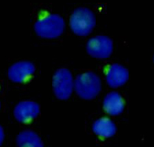 RANBP9 Monoclonal Antibody