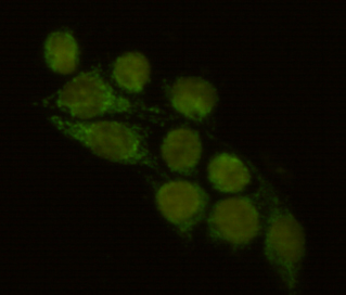 FYB Monoclonal Antibody