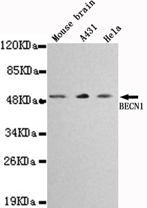 BECN1 Monoclonal Antibody