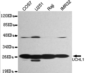 UCHL1 Monoclonal Antibody