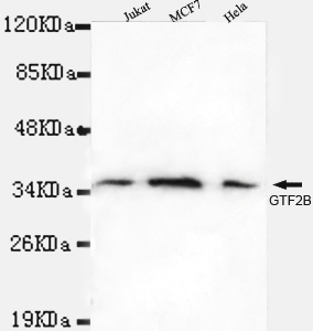 TFIIB Monoclonal Antibody