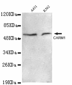 CARM1 Monoclonal Antibody