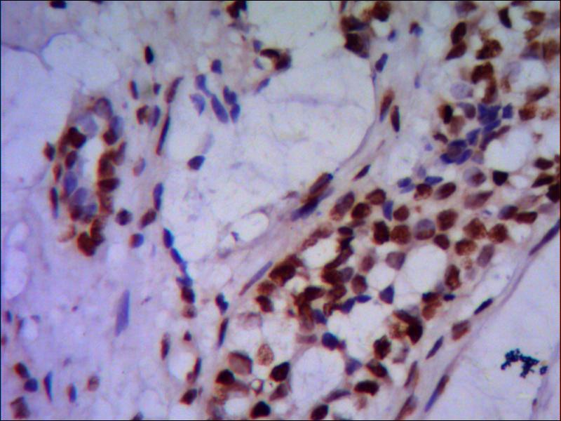 PRMT6 Monoclonal Antibody