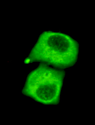 Pyruvate Dehydrogenase(C-term) Monoclonal Antibody