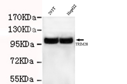 TRIM28 Monoclonal Antibody