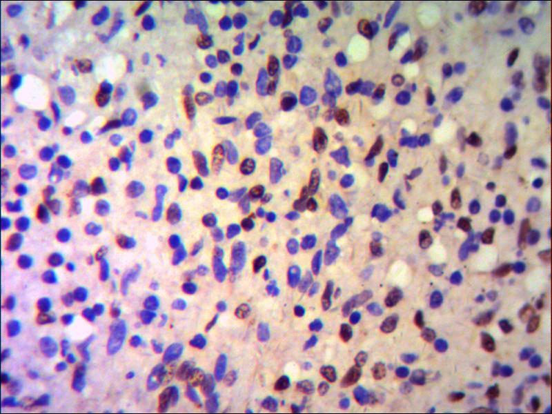 TRIM28 Monoclonal Antibody