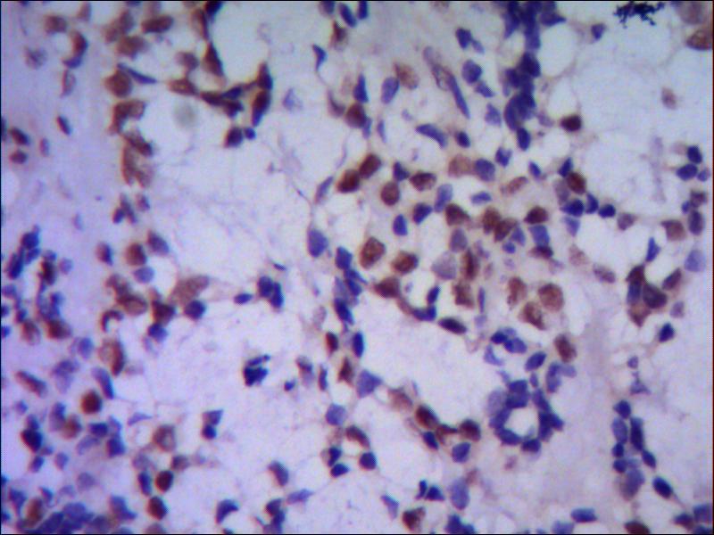 TBLR1 Monoclonal Antibody