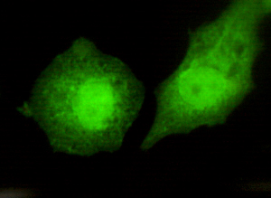 TBLR1 Monoclonal Antibody