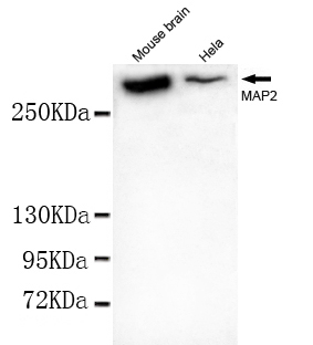 MAP2(N-term) Monoclonal Antibody