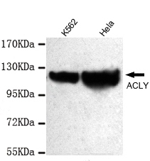 ATP-Citrate Lyase(C-term) Monoclonal Antibody