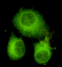 ATP-Citrate Lyase(C-term) Monoclonal Antibody