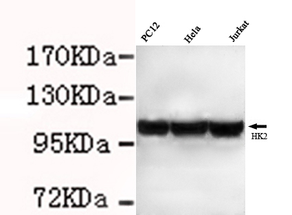 Hexokinase-2( N-term) Monoclonal Antibody