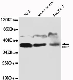 ARRB1 Monoclonal Antibody