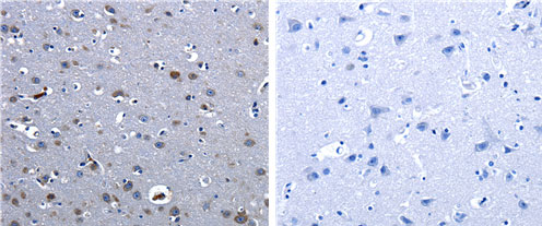 CBFA1 Antibody