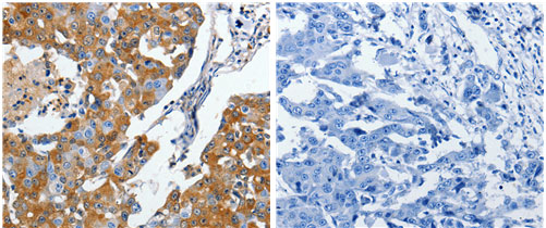 CRMP5 Antibody