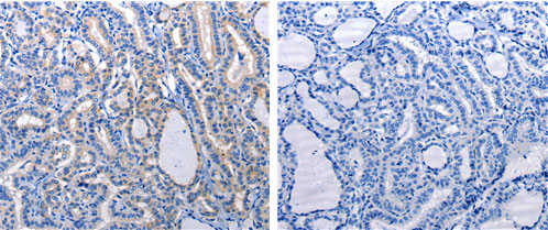 GJB6 Antibody