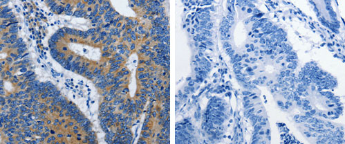 BPIFB3 Antibody