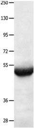 BPIFB3 Antibody