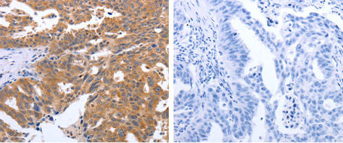 GEMIN2 Antibody