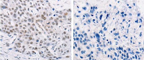 TRIM63 Antibody