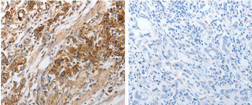 NPY1R Antibody