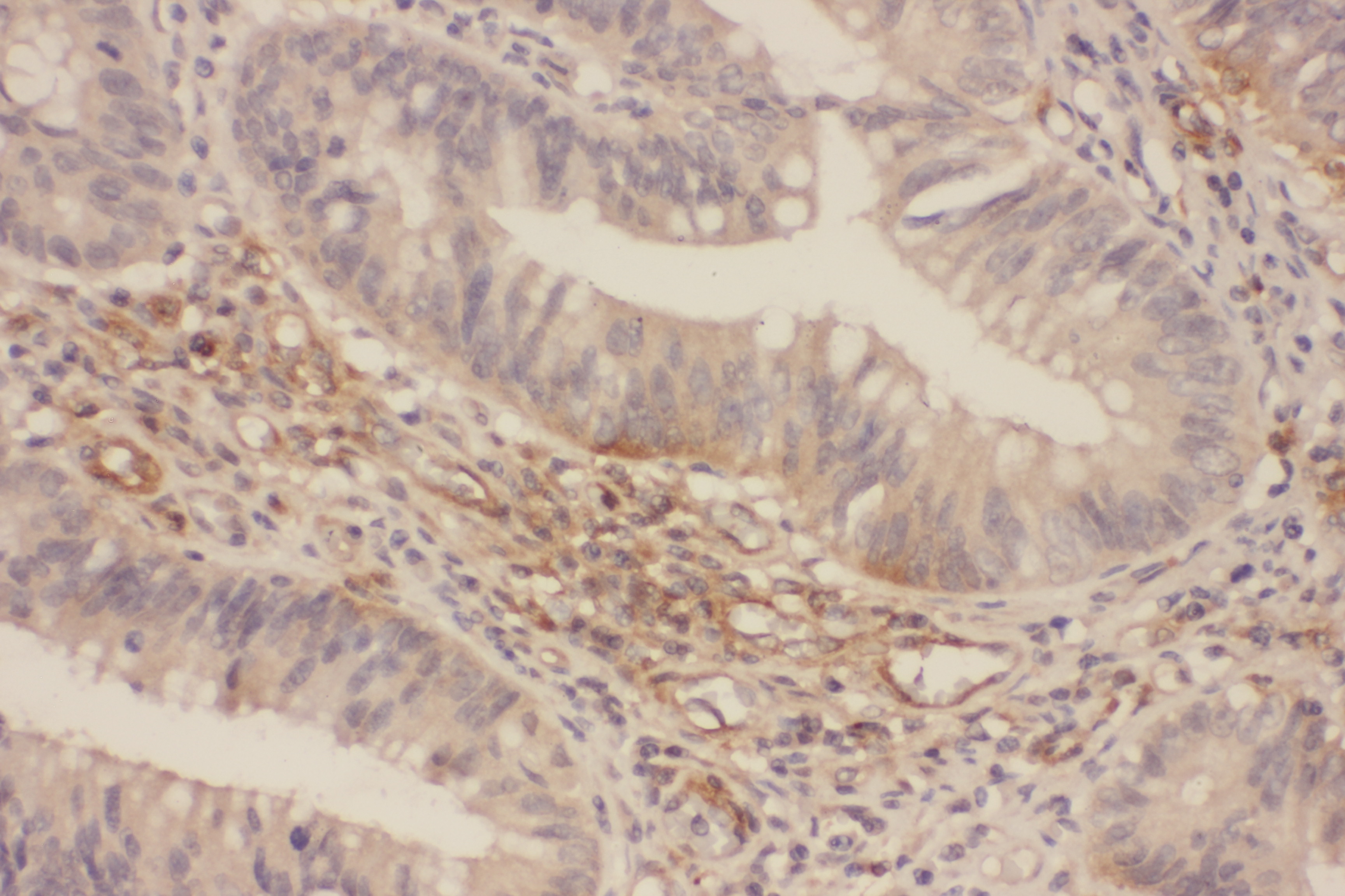 p44/42 MAP Kinase(Ab-202) Antibody