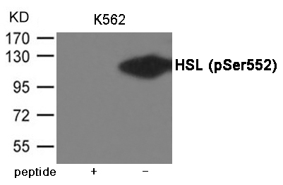 HSL (Phospho-Ser552) Antibody