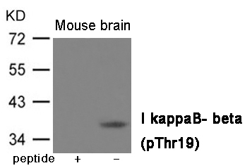 IkappaB- beta (Phospho-Thr19) Antibody