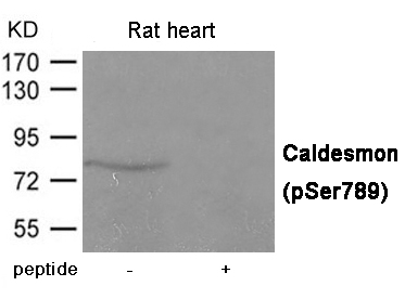 Caldesmon (Phospho-Ser789) Antibody