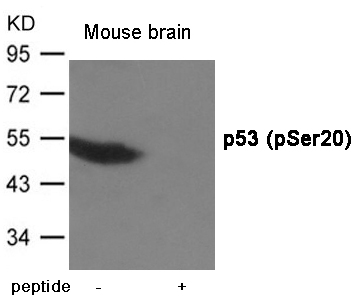 p53 (Phospho-Ser20) Antibody