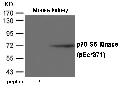 p70 S6 Kinase (Phospho-Ser371) Antibody