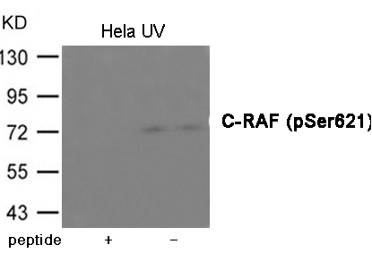 C-RAF (Phospho-Ser621) Antibody