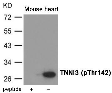 TNNI3 (Phospho-Thr142) Antibody