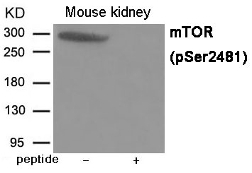 mTOR (Phospho-Ser2481) Antibody