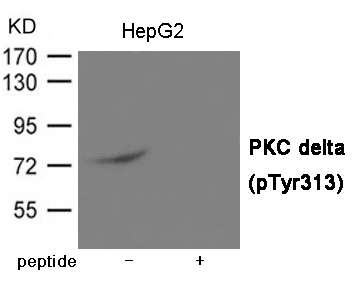 PKC delta (Phospho-Tyr313) Antibody