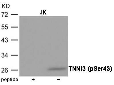 TNNI3 (Phospho-Ser43) Antibody