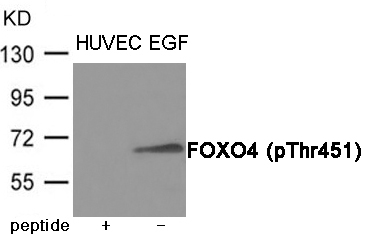 FOXO4 (Phospho-Thr451) Antibody