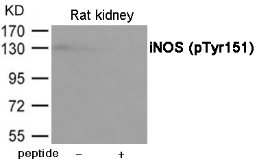 iNOS (Phospho-Tyr151) Antibody