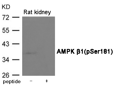 AMPK β1(Phospho-Ser181) Antibody