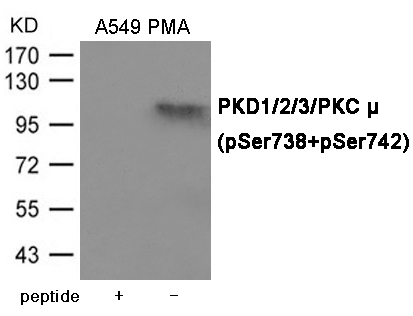 PKD1/2/3/PKC μ (Phospho-Ser738/742) Antibody