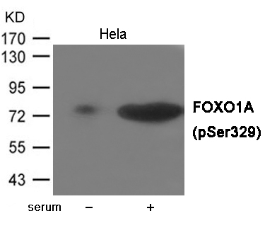 FOXO1A (Phospho-Ser329) Antibody