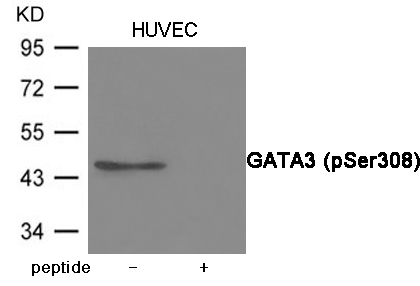 GATA3 (Phospho-Ser308) Antibody