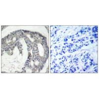 eNOS(Phospho-Ser1177) Antibody