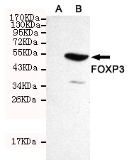 FOXP3 Monoclonal Antibody