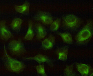 CBR1 Monoclonal Antibody