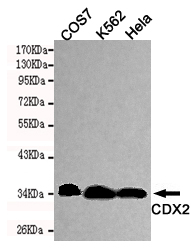 CDX2 Monoclonal Antibody