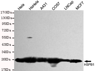 Hsp27 Monoclonal Antibody