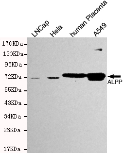 Placental alkaline phosphatase (PLAP) Monoclonal Antibody