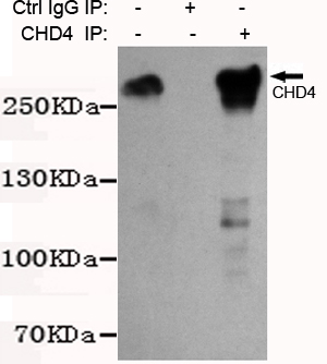 CHD4 Monoclonal Antibody